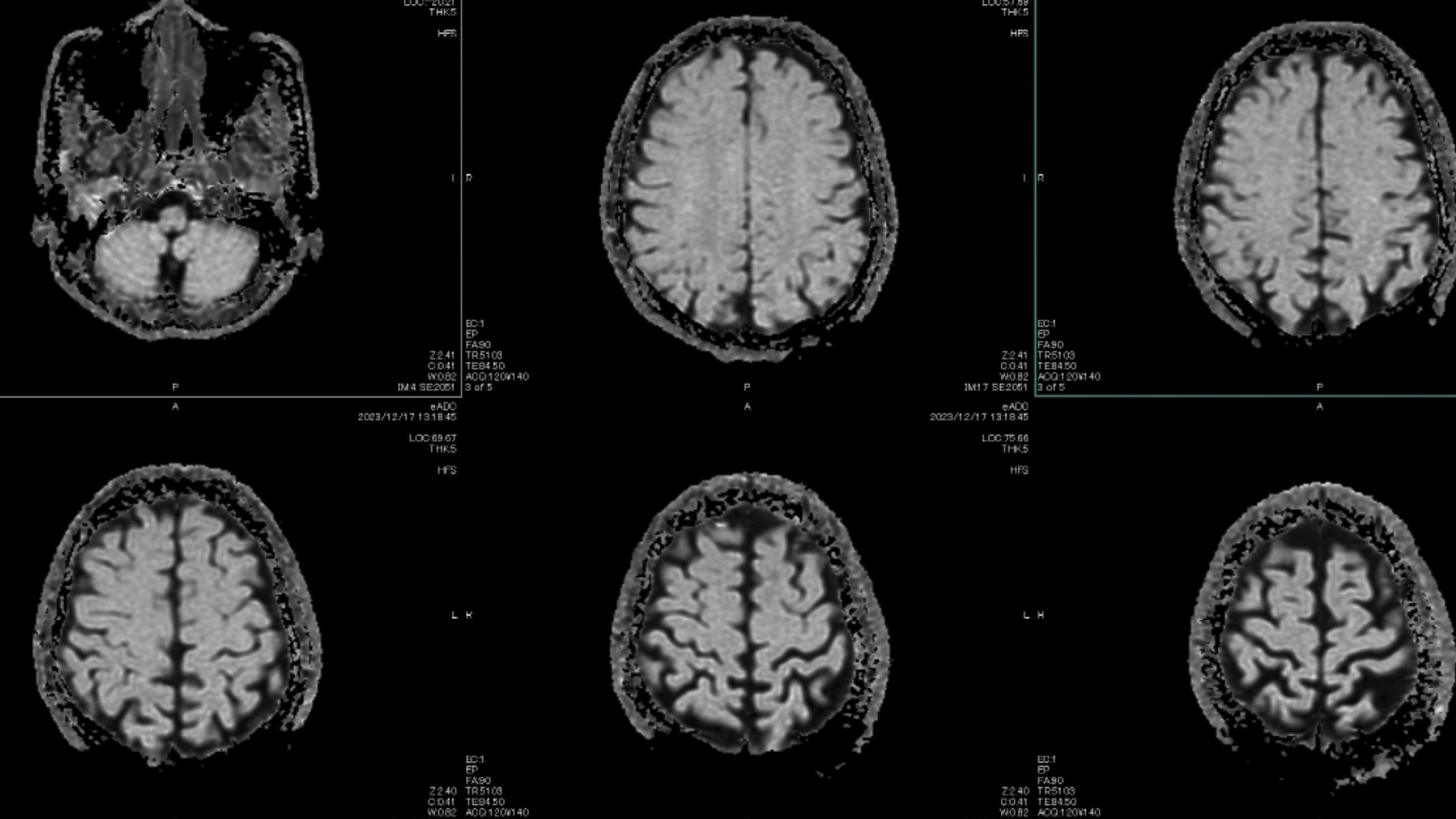 V&aacute;rias imagens do c&eacute;rebro humano dispostas lado a lado