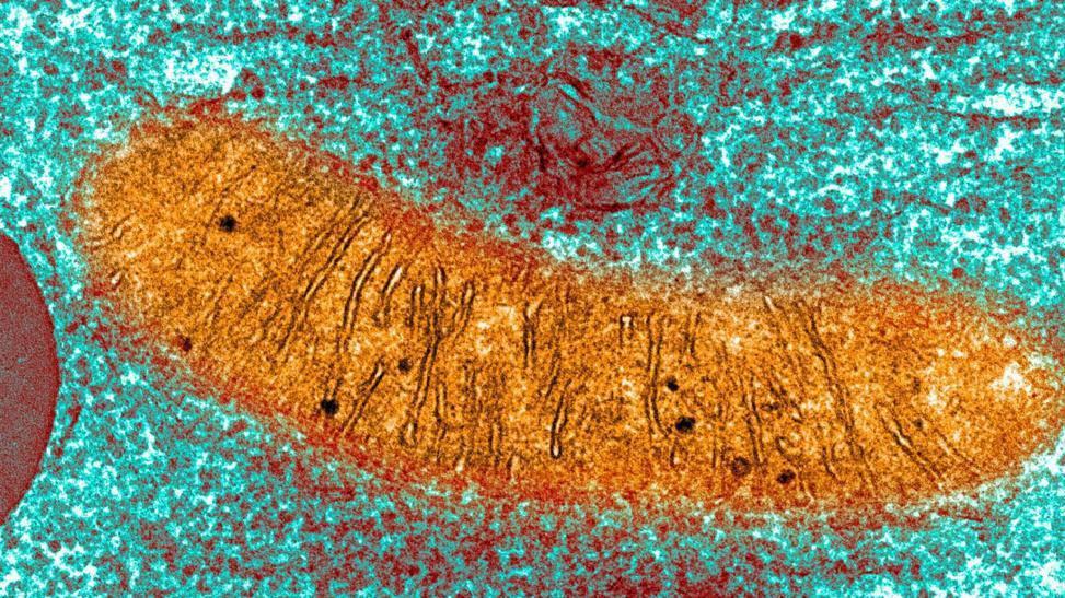 Una imagen de una mitocondria tomada con un microscopio