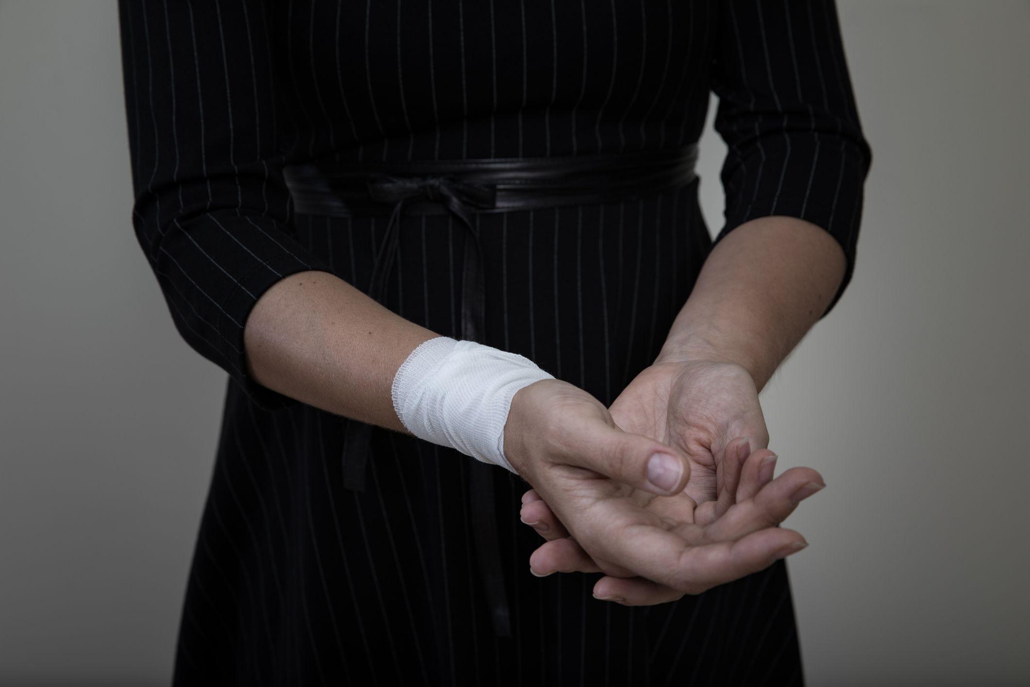 امرأة تعاني من إصابة في يدها