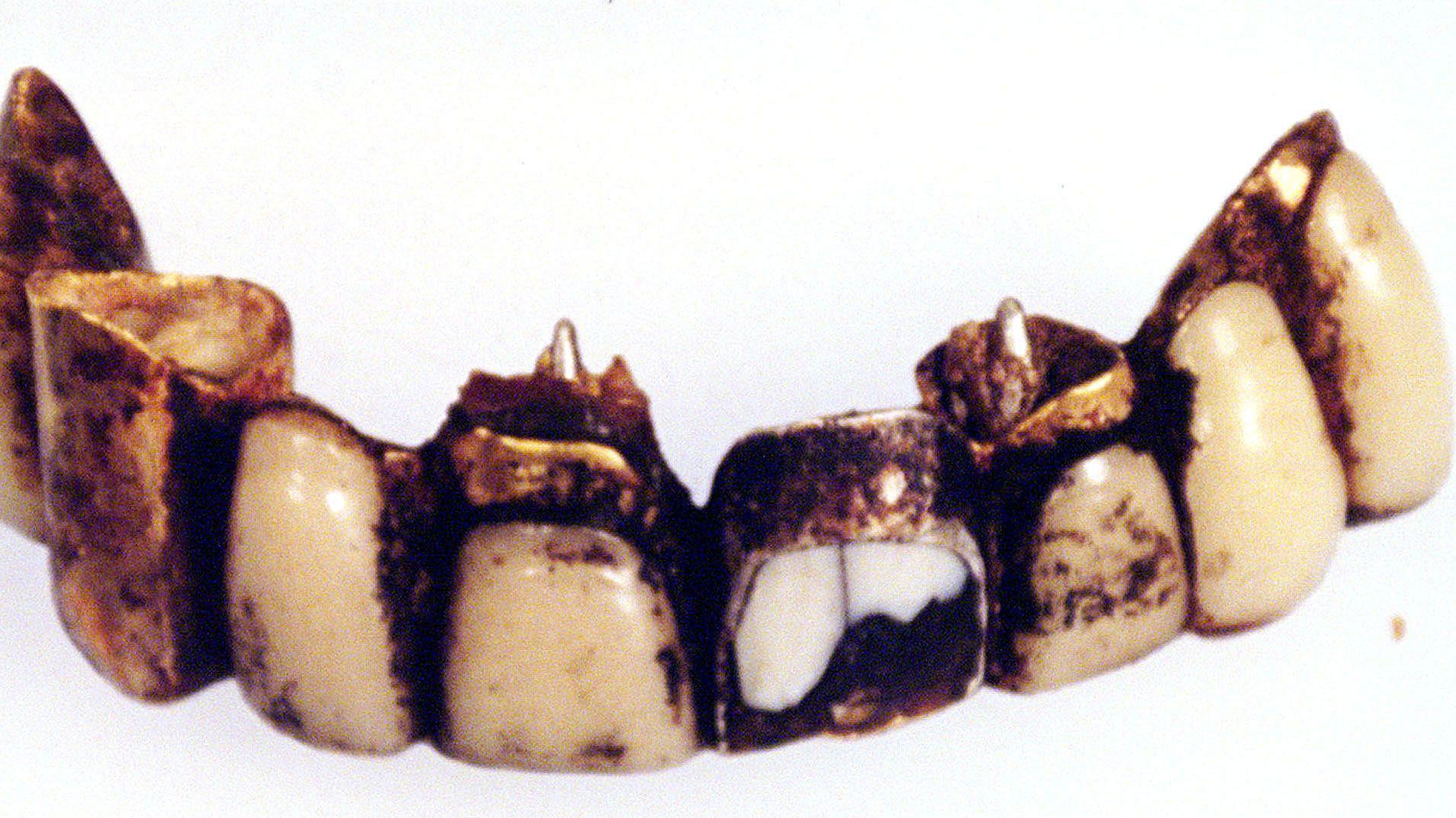 照片顯示一排專家相信是納粹德國獨裁者遺骸的顎骨連牙齒，這張照片在俄羅斯莫斯科展出（2000年4月）