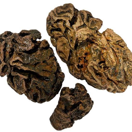 Fragmentos del cerebro de un individuo enterrado en Reino Unido hace cerca de 200 años