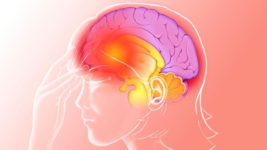 Ilustración de cefaleas y migraña