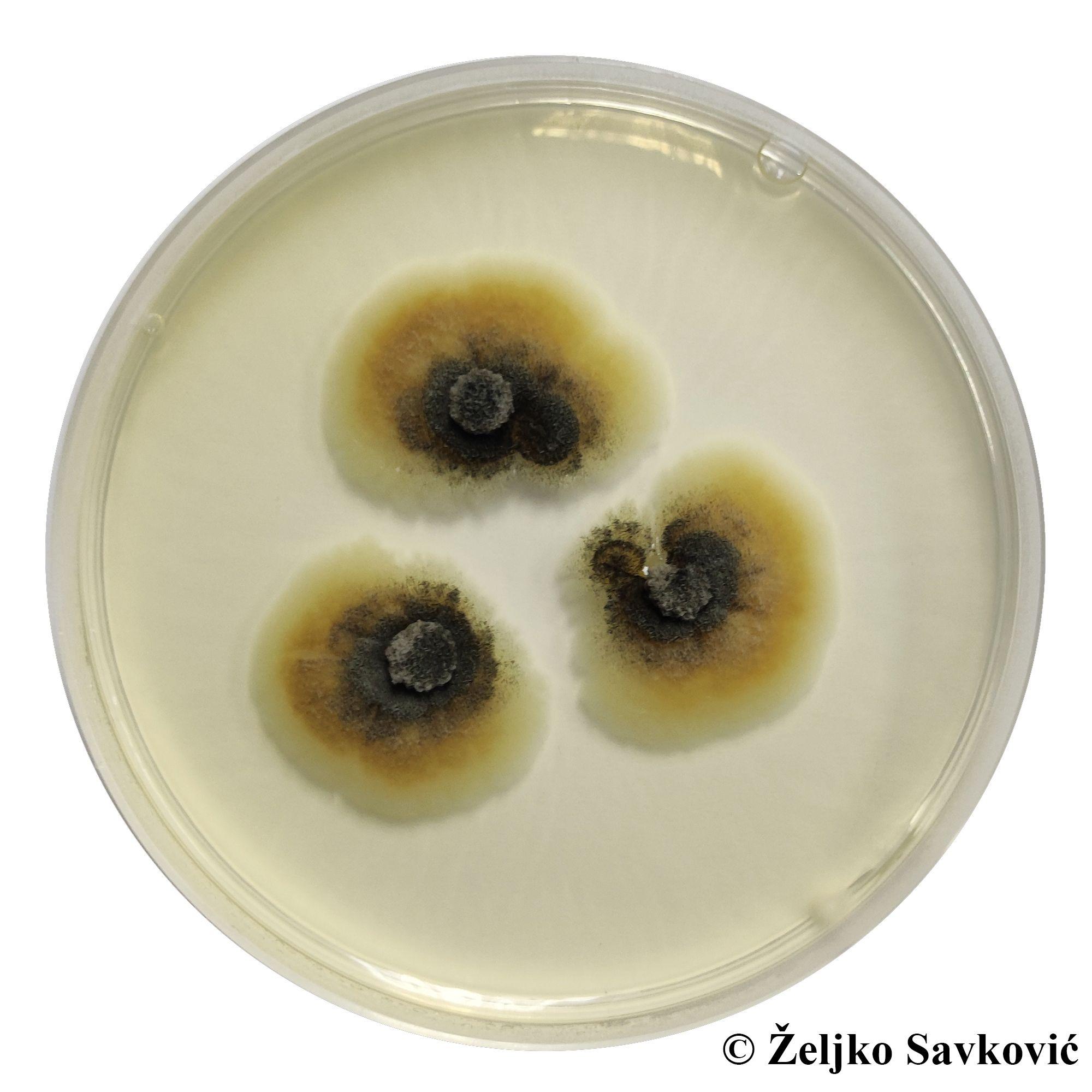 'Betmenova gamsia': Nova vrsta gljive nazvana po superheroju 3 Mikroskopski prikaz nove vrste gljiva