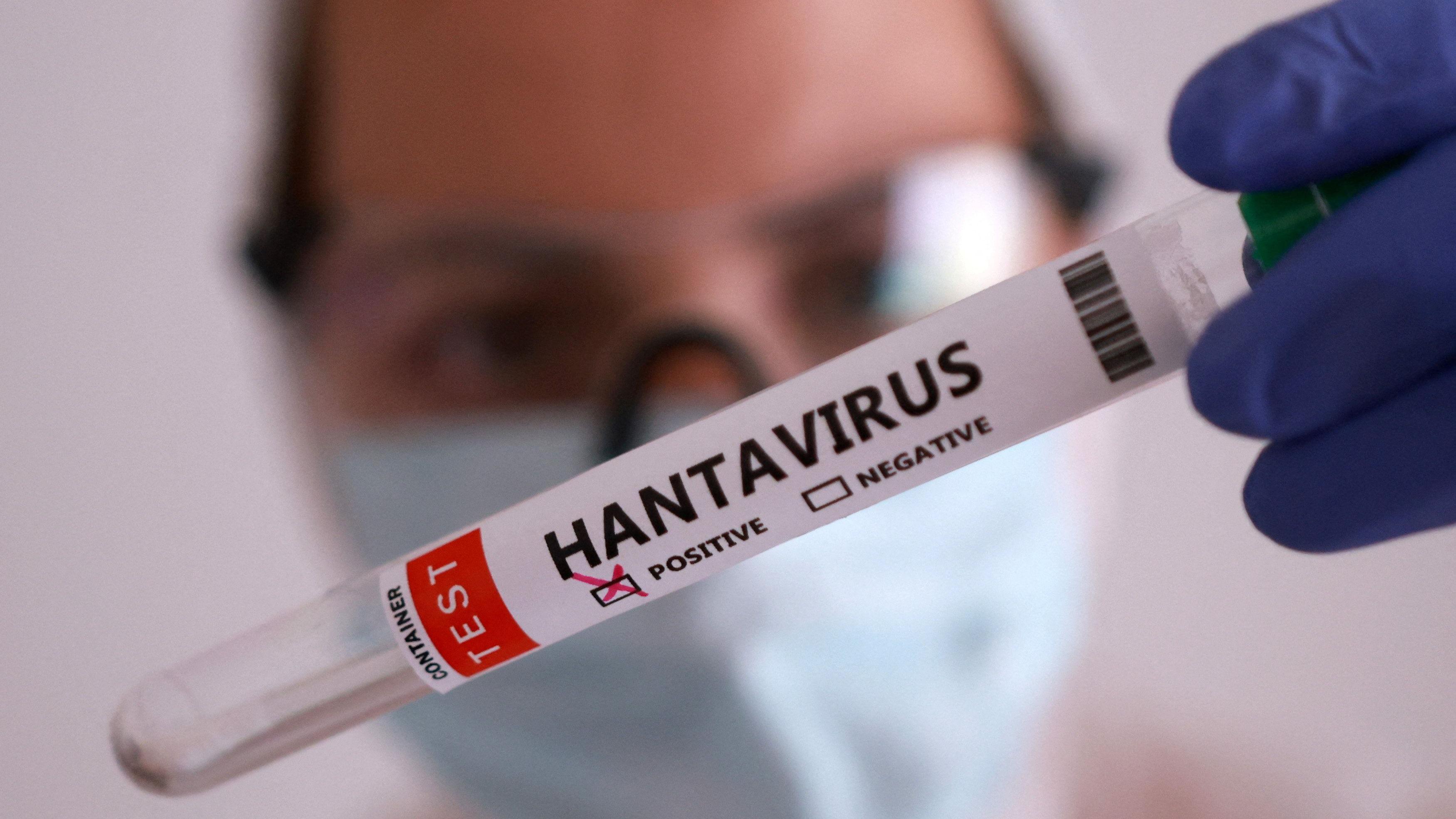Una persona con mascarilla sostiene un tubo de ensayo etiquetado como "Hantavirus positivo".