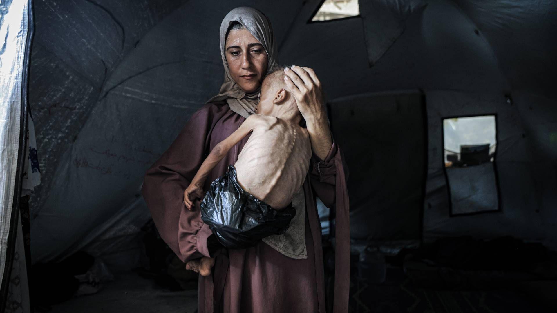 Gazans wasting away as mass starvation spreads, humanitarian groups warn