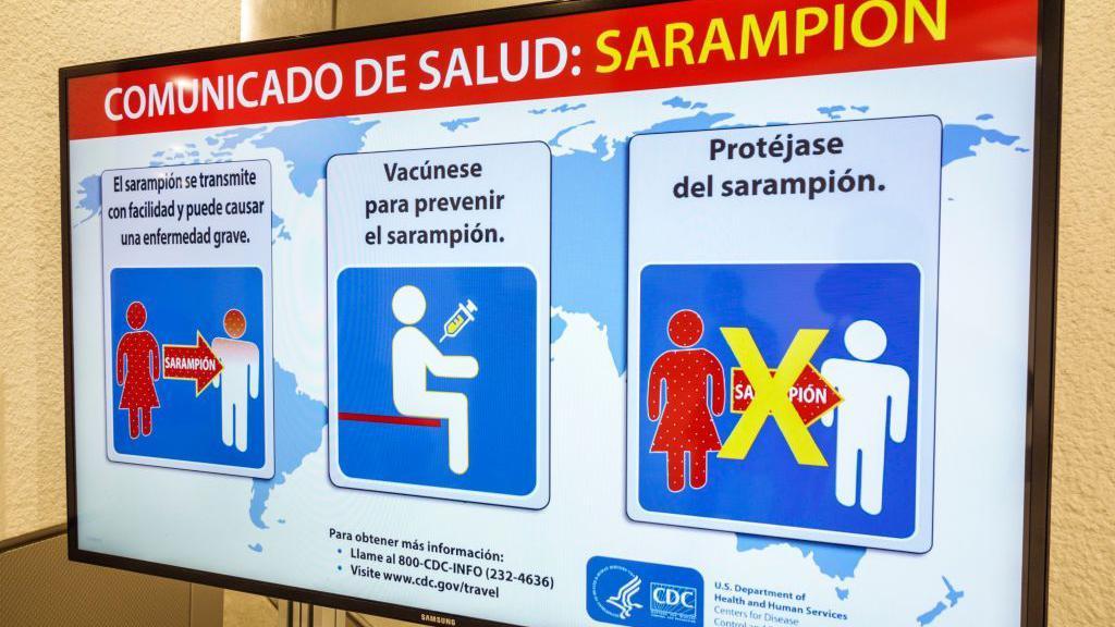 Advertencia sobre sarampión en el Aeropuerto Internacional de Miami.