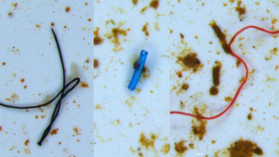 Estruturas coloridas que representam micropl&aacute;sticos vistos por um microsc&oacute;pio que analisou tecidos de girinos amaz&ocirc;nicos