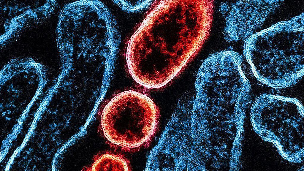 Transmisiona elektronska mikrografija zrelih ekstracelularnih vezikula nipa virusa (crveno) blizu periferije zaražene Vero ćelije (plavo)