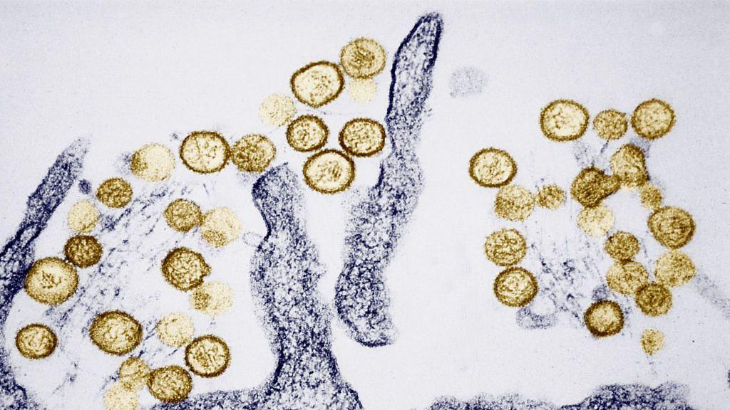 Imagen de un virus en un microscopio.