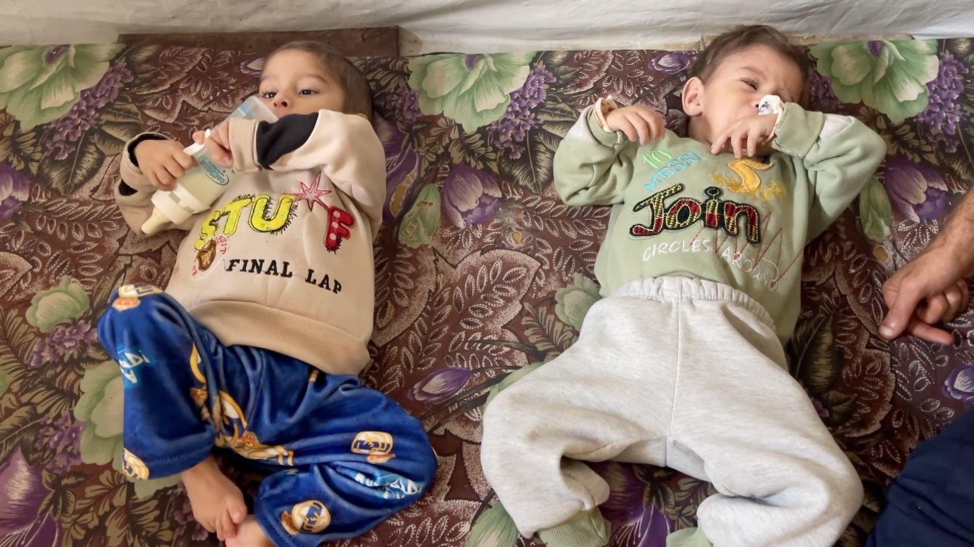 صورة الطفلين عدي ومحمد في نوفمبر/تشرين الثاني 2025 يبدو عليهما بعض التحسن مقارنة بوضعهما في آب/أغسطس 2025