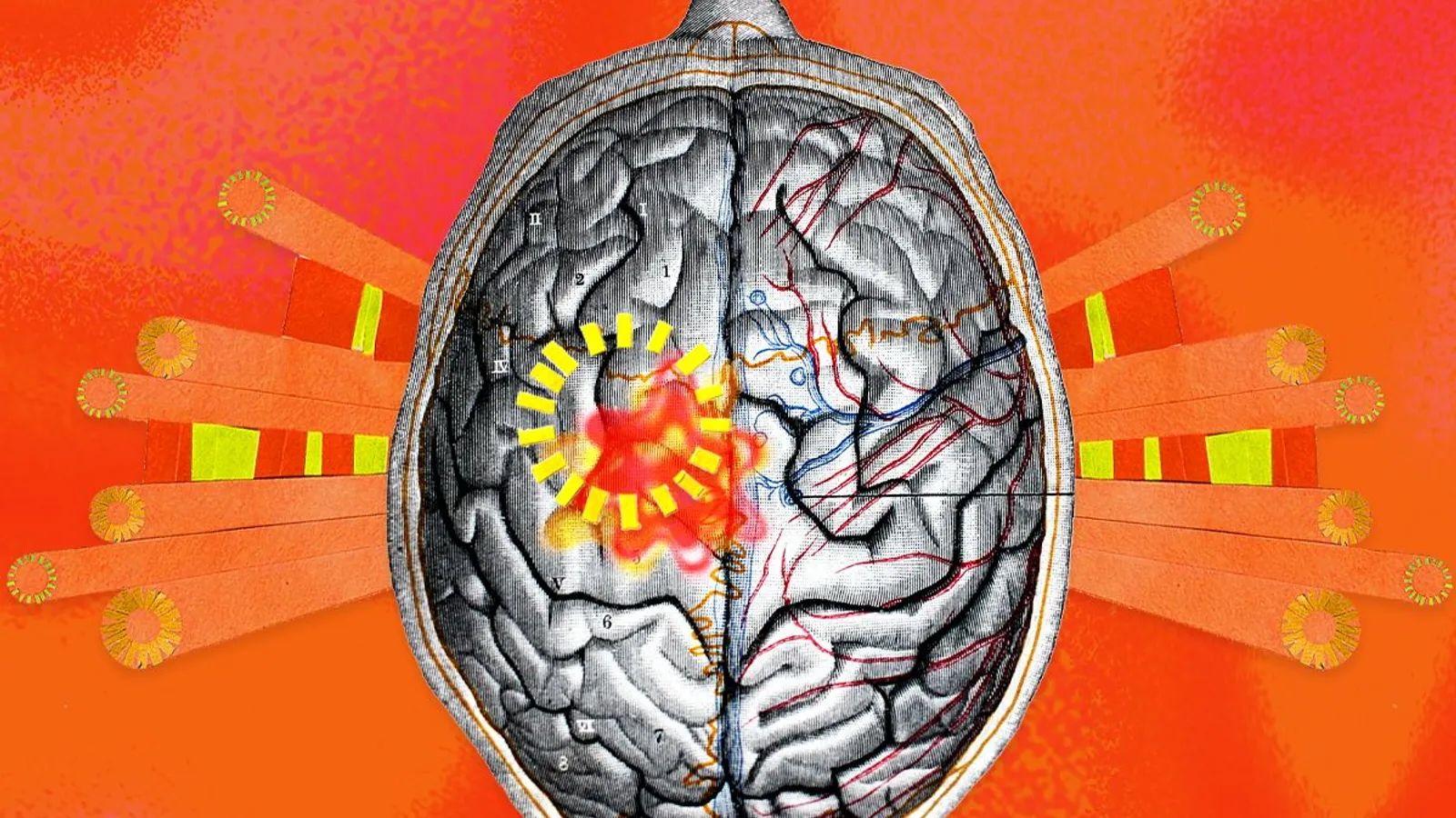 一個大腦的製圖