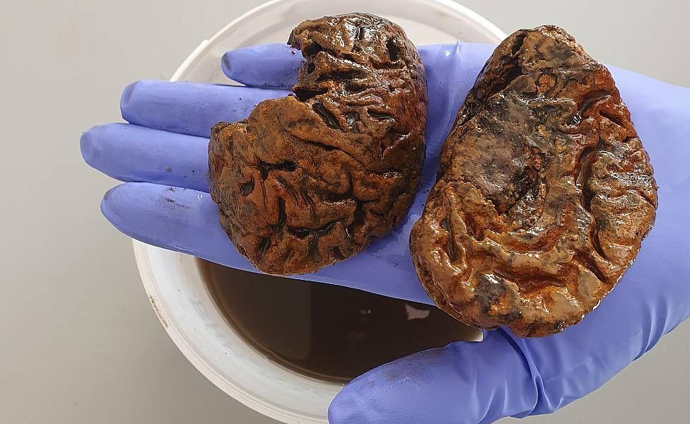 Dos hemisferios cerebrales antiguos