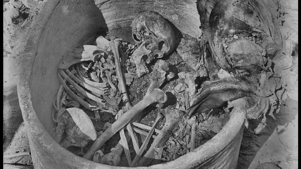 Una fotografía en blanco y negro que muestra una colección de huesos, incluyendo el cráneo de una persona, en un recipiente circular.