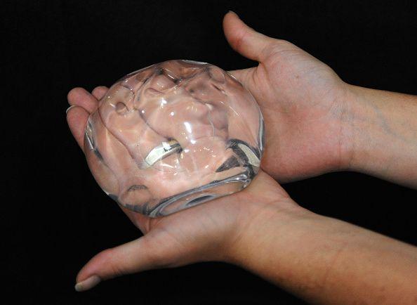 بریسٹ امپلانٹس