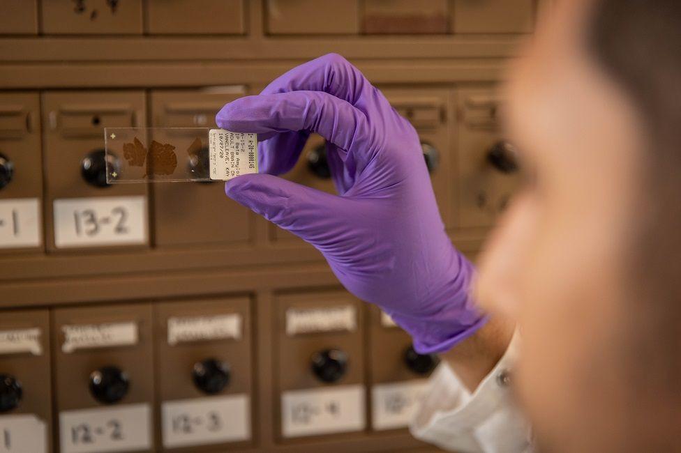 Una investigadora con un guante de látex morado sostiene una muestra de un cerebro fijada en un portaobjetos de vidrio y detrás hay una especie de archivo
