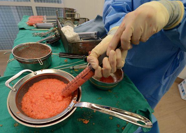 Surgery