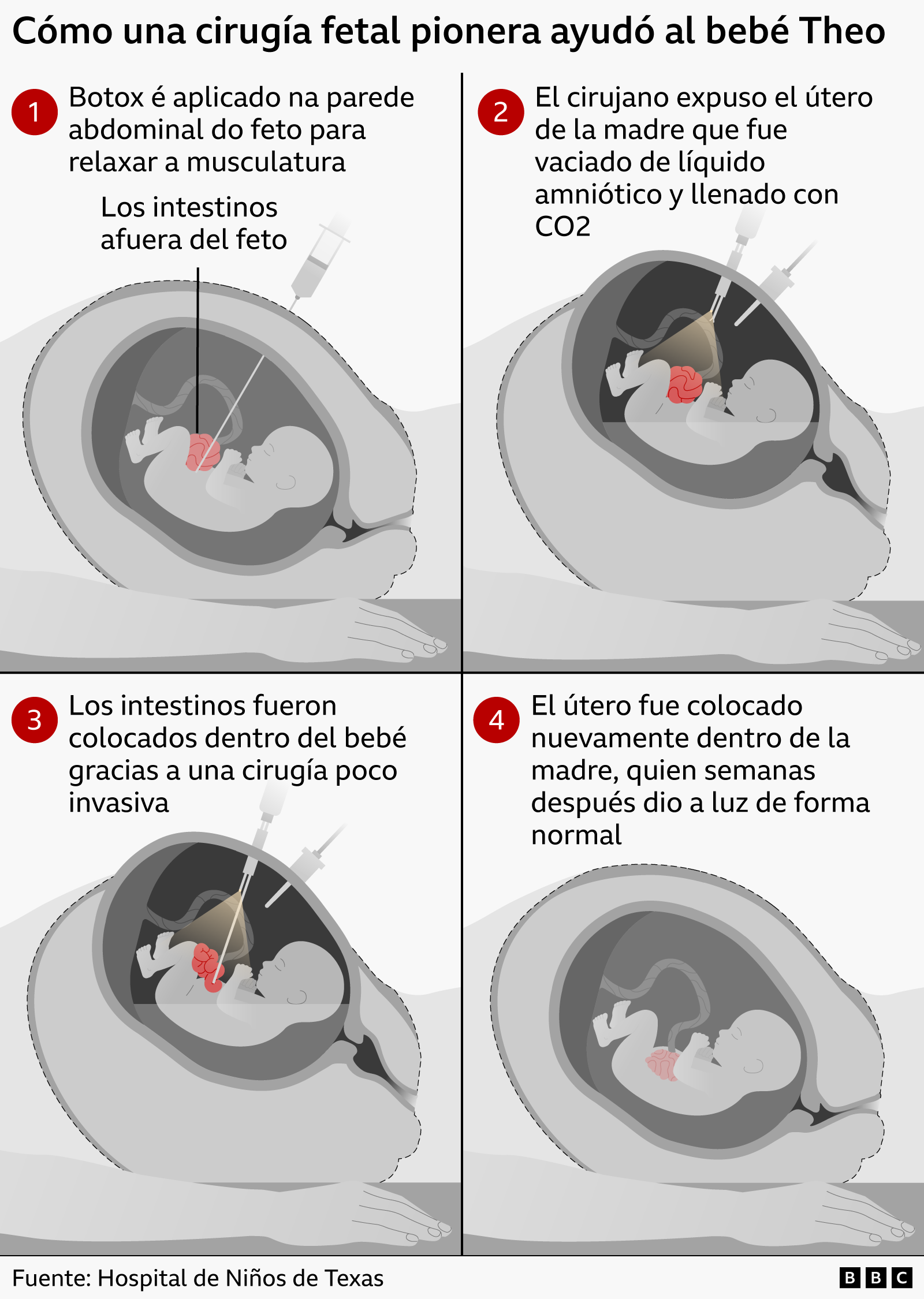 Gráfico