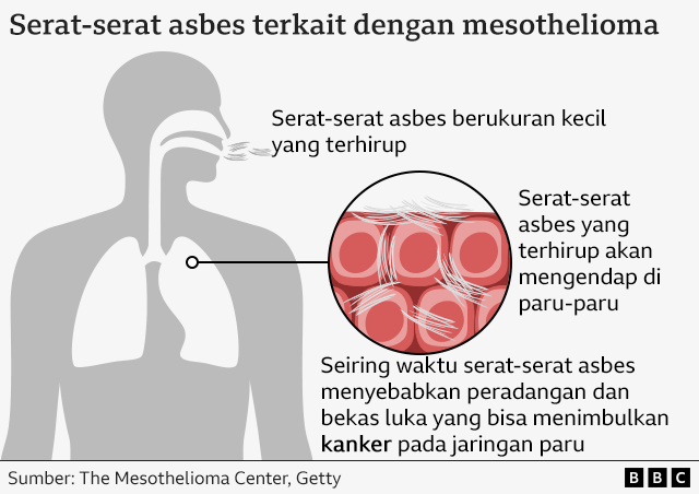 bahaya asbes