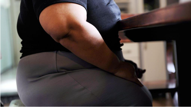 شخص يعاني من السمنة.