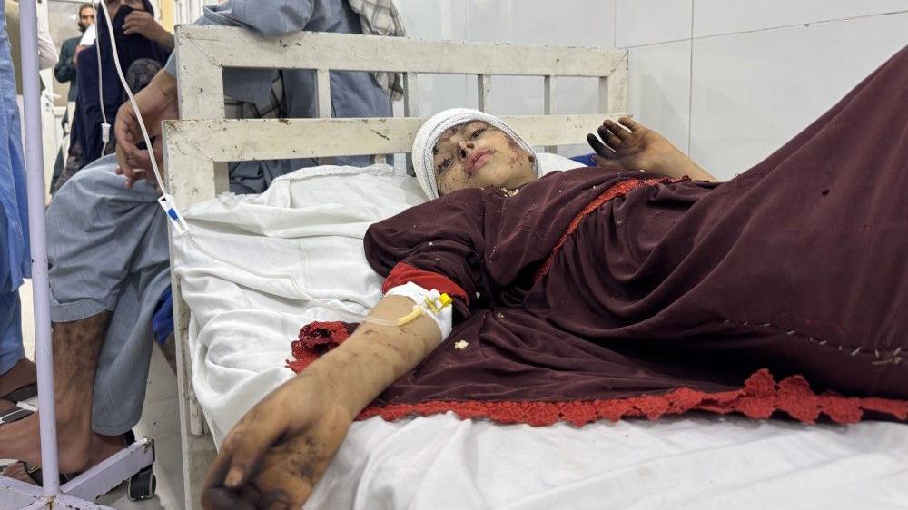 zemljotres u avganistanu, avganistan, zemljotres, povređena devojčica leži u bolnici