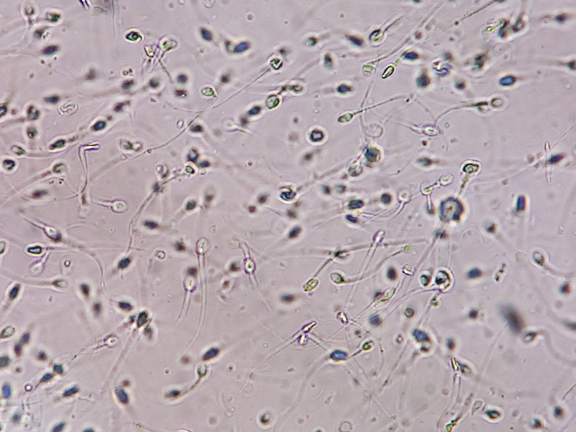 Vista microscópica de numerosos espermatozoides dispersos en una muestra biológica.