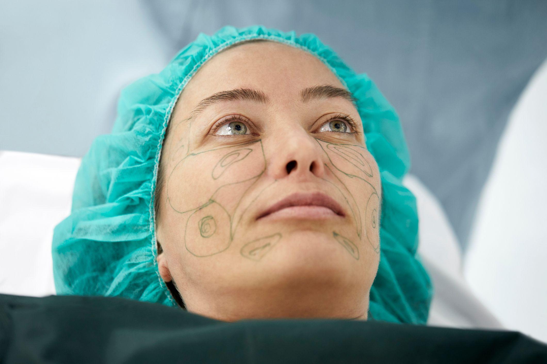 Una mujer, cubierta con un gorro quirúrgico y líneas dibujadas en el rostro. 
