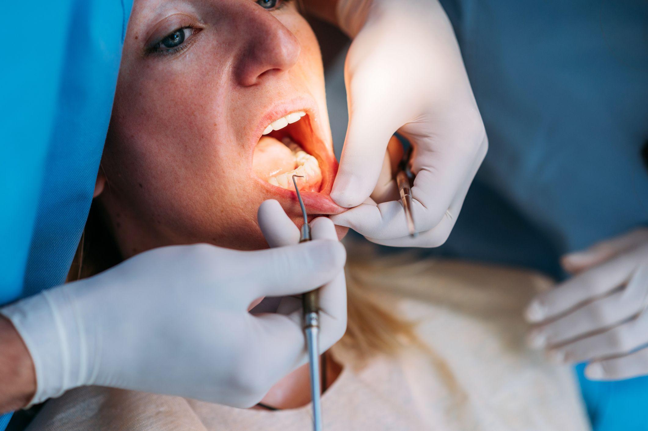 Una mujer en el dentista.