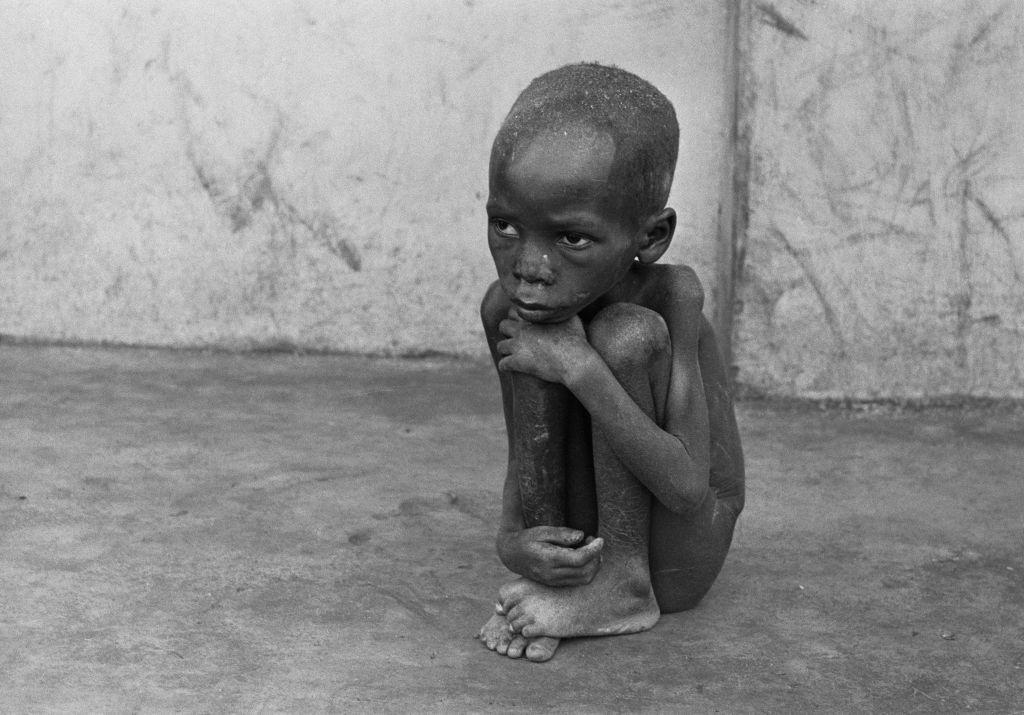 Un niño biafreño, famélico y desnudo, está sentado en una acera durante la Guerra Civil Nigeriana, el 25 de julio de 1968.