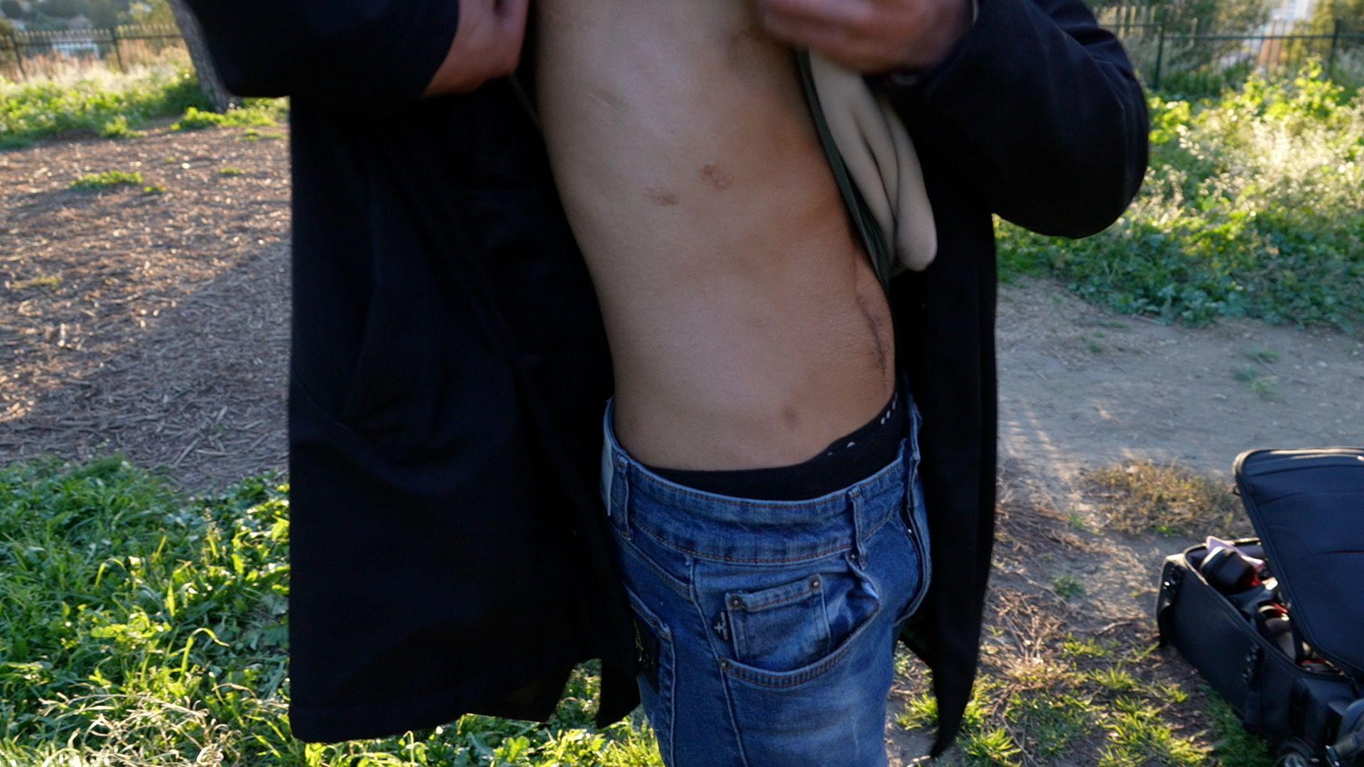 El Inmortal, miembro de una pandilla de Marsella, muestra sus heridas de bala en un ataque de una pandilla rival.