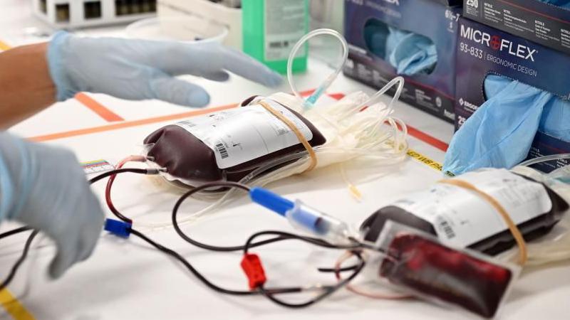 Jehovahs Witnesses ease rules on blood transfusions 