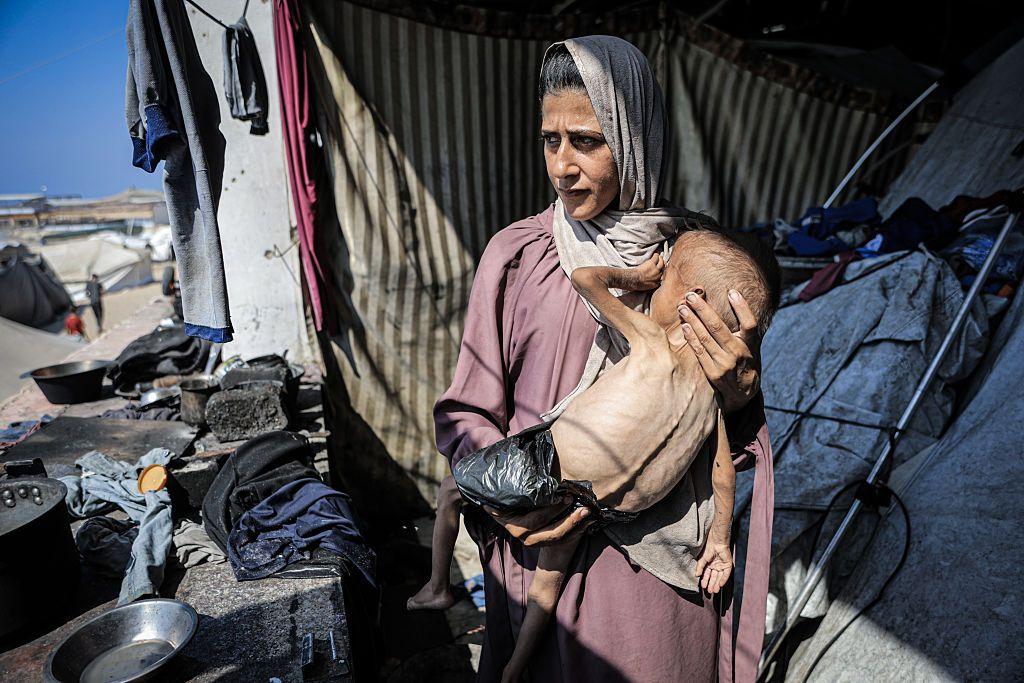 Una madre en Gaza con su hijo desnutrido.