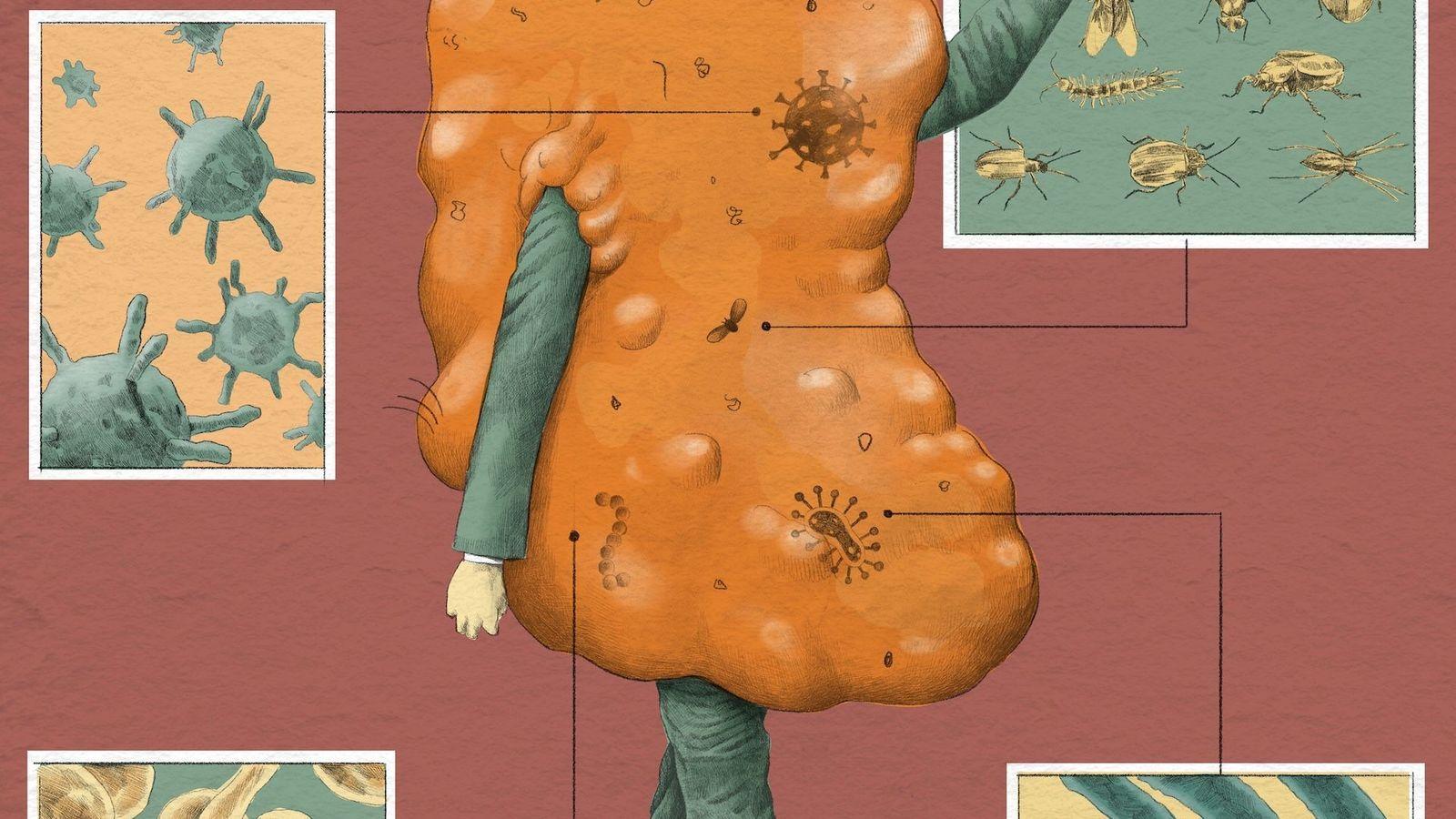 Dibujo que representa al cerumen