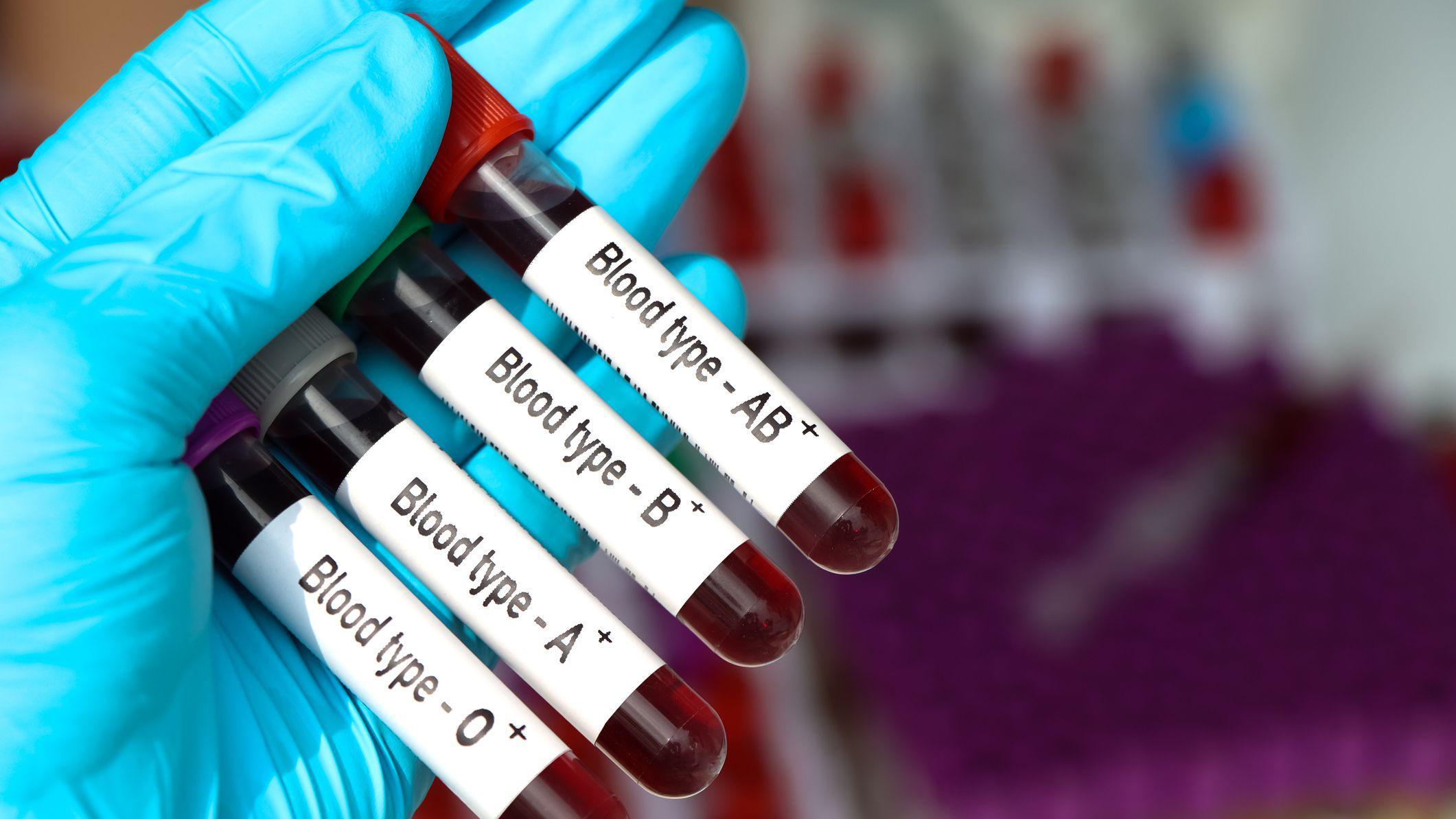 Mão com luva azul segura quatro ampolas com sangue de diferentes tipos