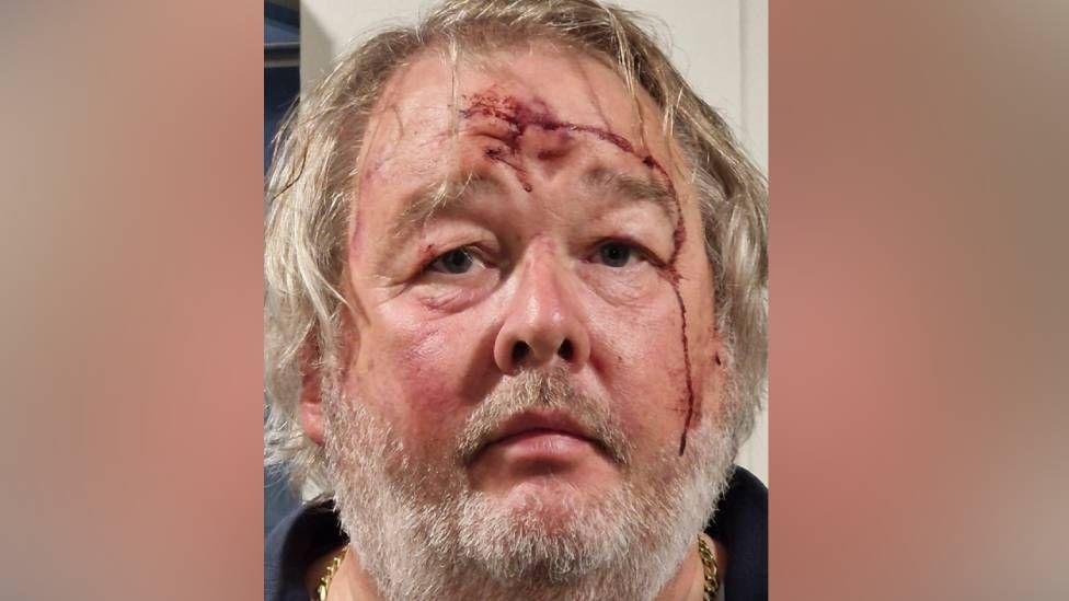 Christopher Mills, de cabelos brancos e barba, com um grande corte na testa.