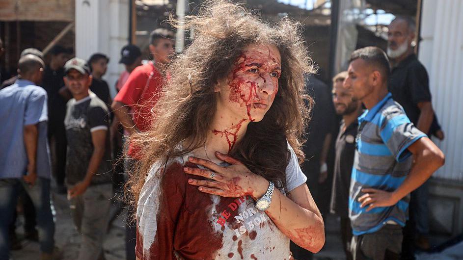 Una mujer herida en el ataque