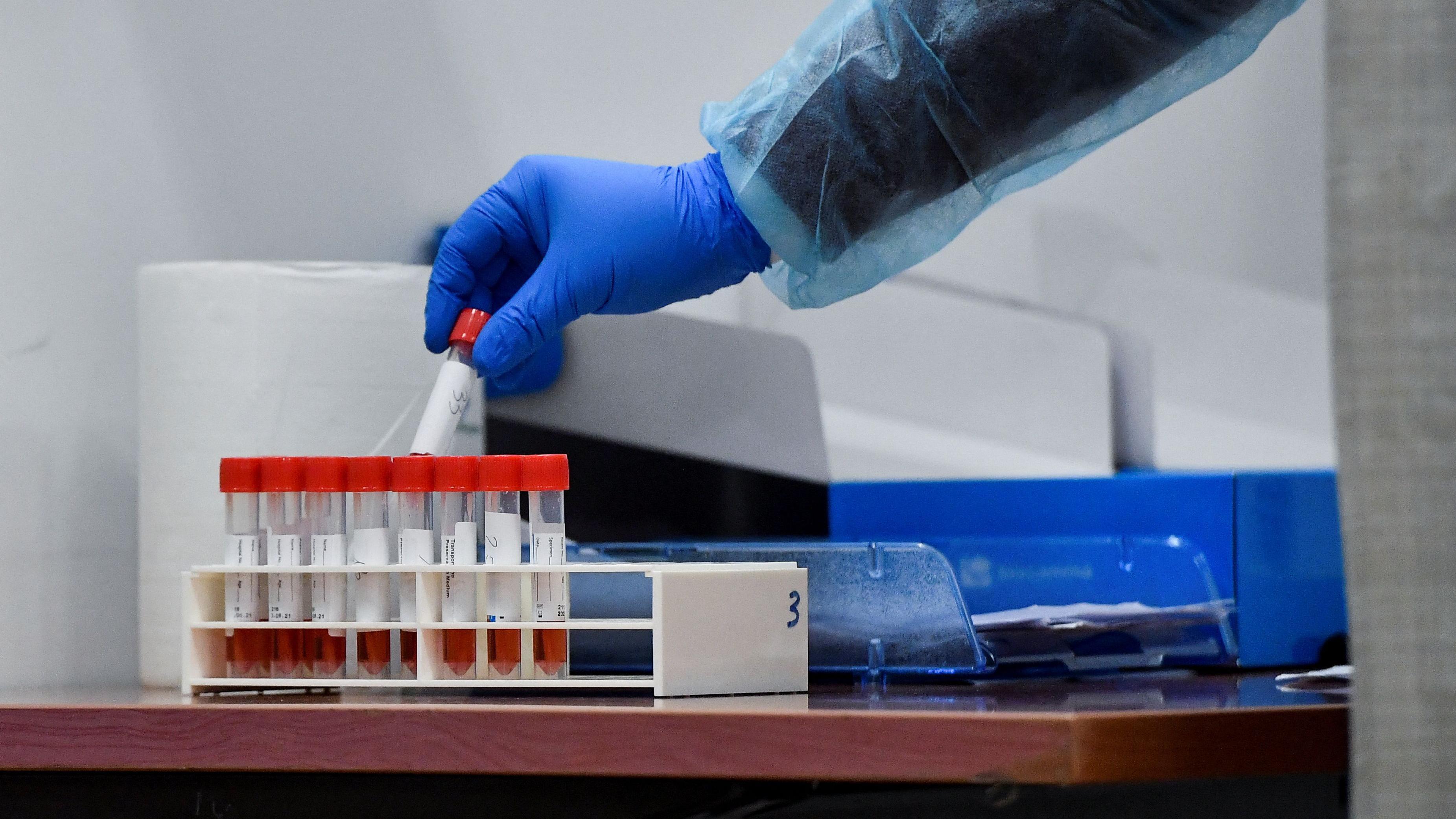 عينات مخبرية