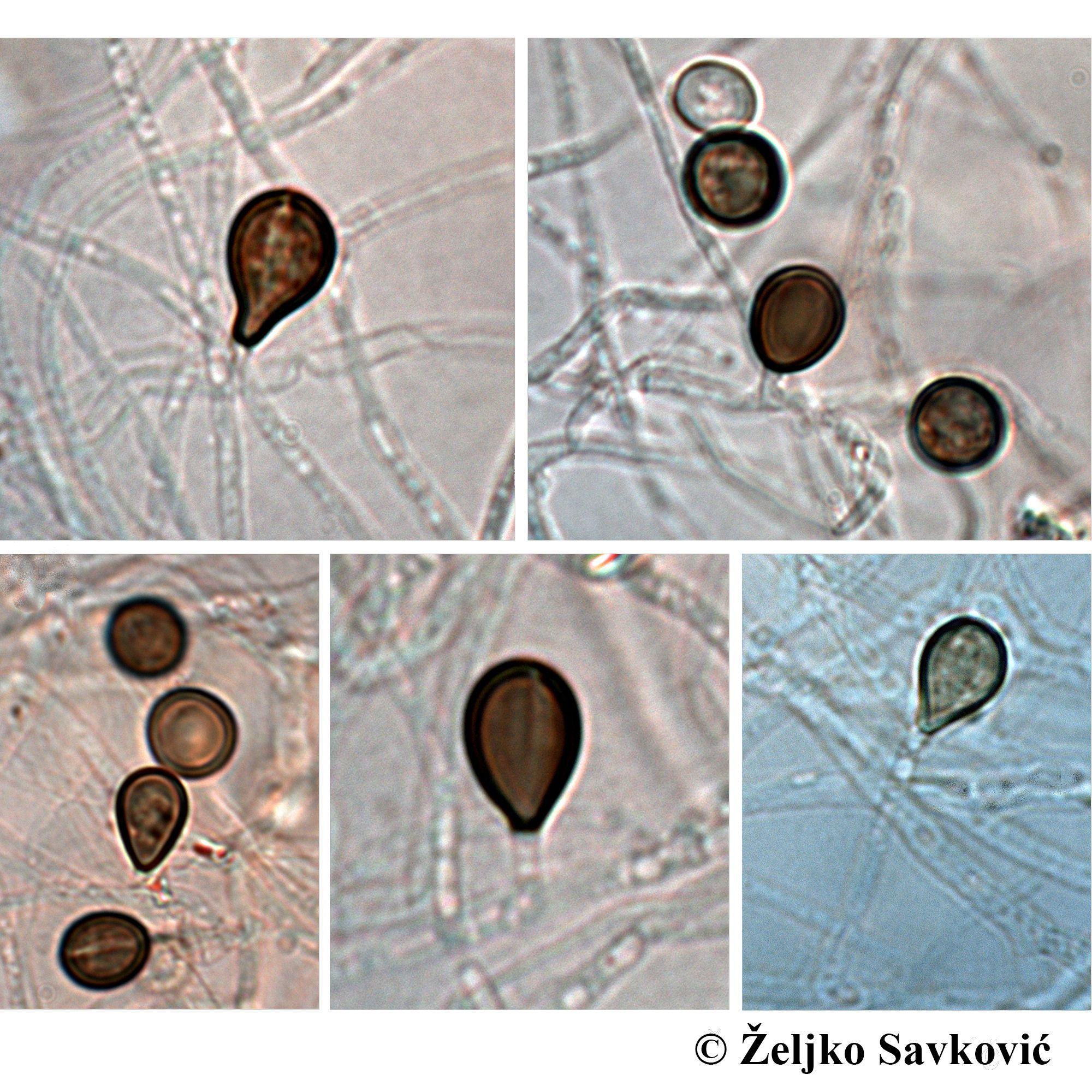 'Betmenova gamsia': Nova vrsta gljive nazvana po superheroju 1 Mikroskopski prikaz mikroorganizama - gljiva