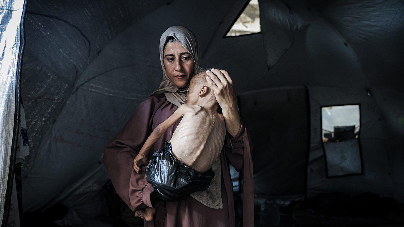 أم تحمل طفل يتضور جوعاً