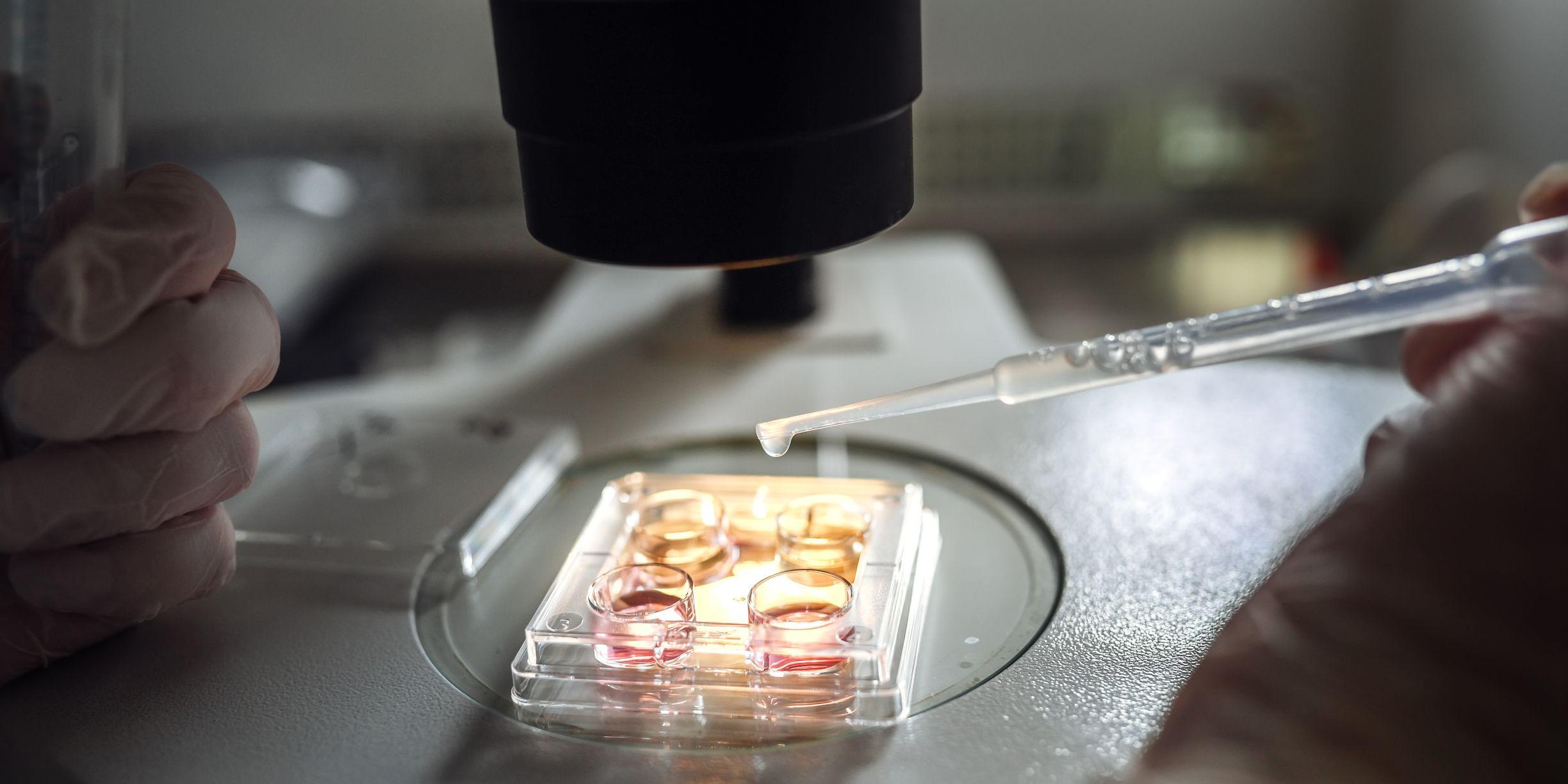 Placas e equipamentos usados em fertilização in vitro
