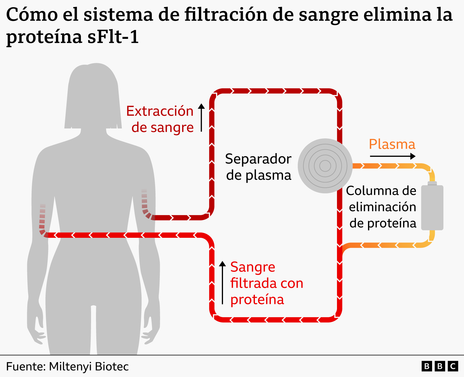El esperanzador ensayo pionero sobre la preeclampsia, la complicación del embarazo que mata a medio millón de bebés al año- El esperanzador ensayo pionero sobre la preeclampsia, la complicación del embarazo que mata a medio millón de bebés al año