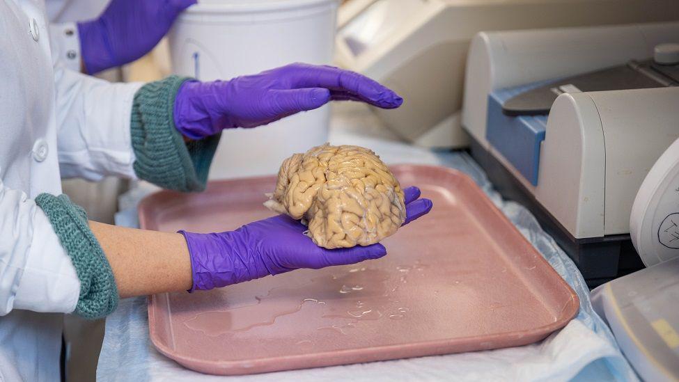 一位科學家戴著橡膠手套，手中拿著一顆大腦，正懸在一個塑膠托盤上方。
