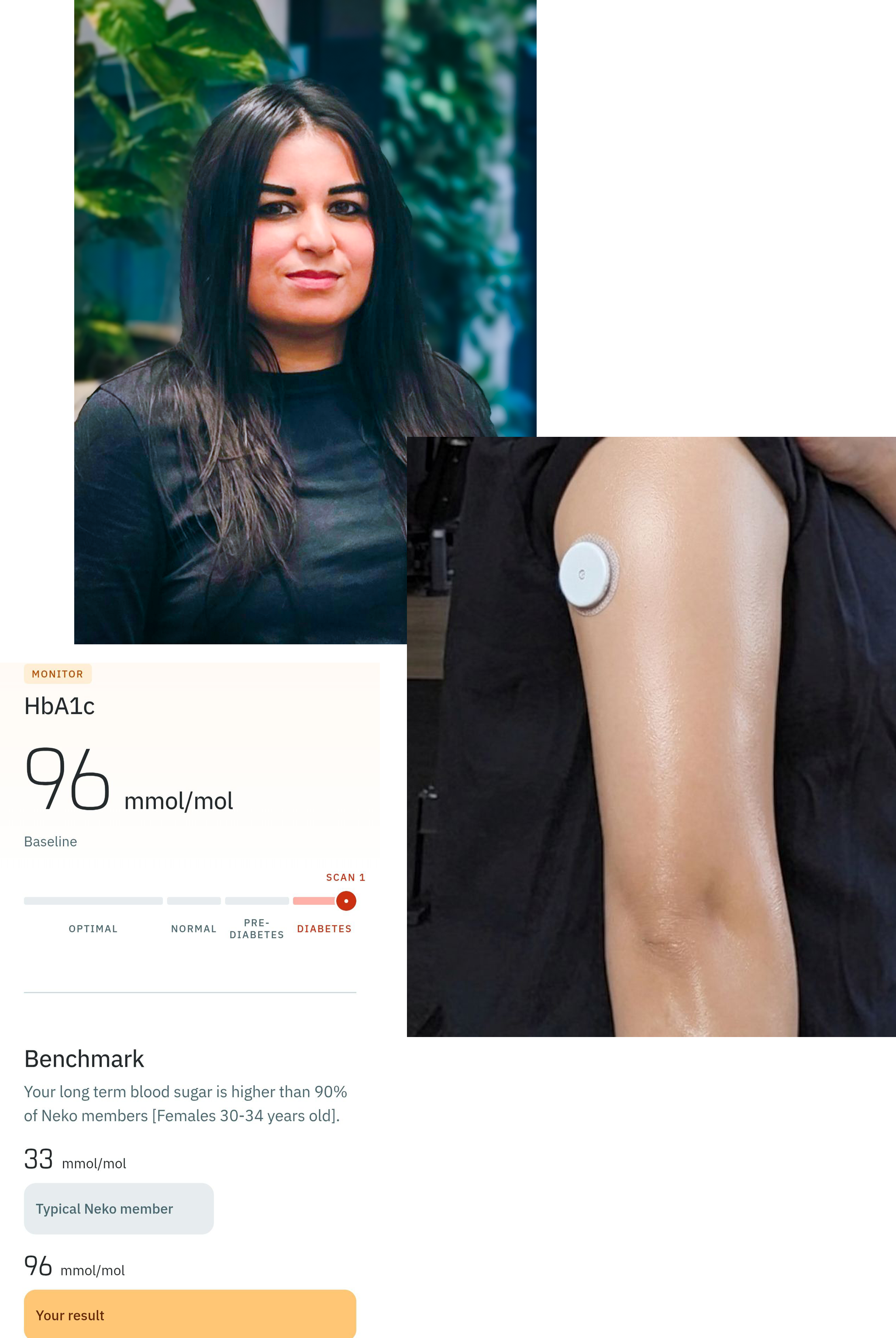 Uma foto de retrato de Mehvish, uma imagem dos resultados de seu exame de glicemia e uma foto de seu bra&ccedil;o com um monitor de glicose acoplado.