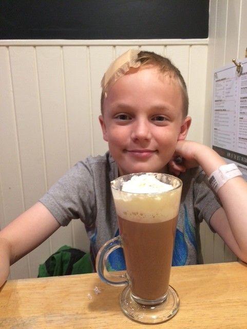 Niño con una gran tirita en el lado derecho de la cabeza. Está sentado detrás de un enorme chocolate caliente con mucha crema encima.