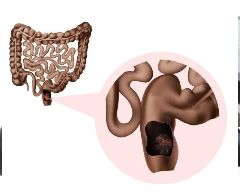 دونوں بیماریوں کا فرق سمجھنا بہتر ہے
