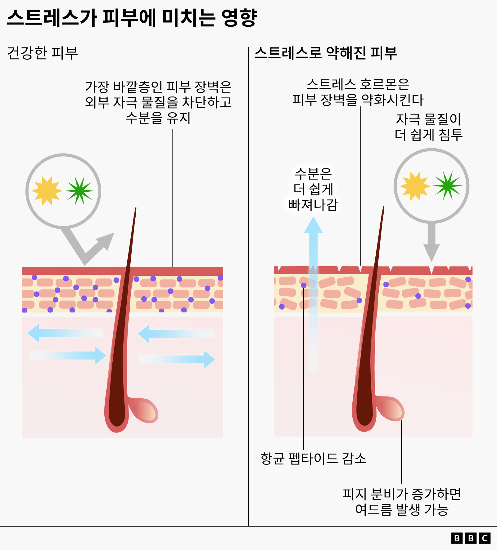 건강한 피부와 스트레스로 손상된 피부의 차이