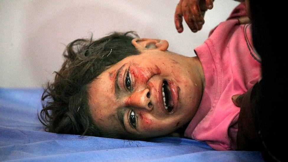 Un niño herido en un ataque israelí en una camilla del hospital Al Awda