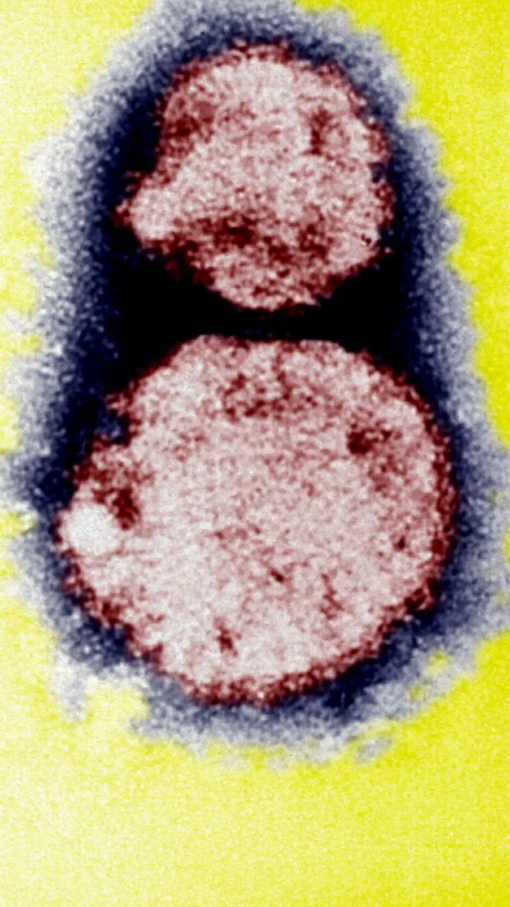 Gịnị bụ nje 'hantavirus' na-ewu ebe niile ugbua?