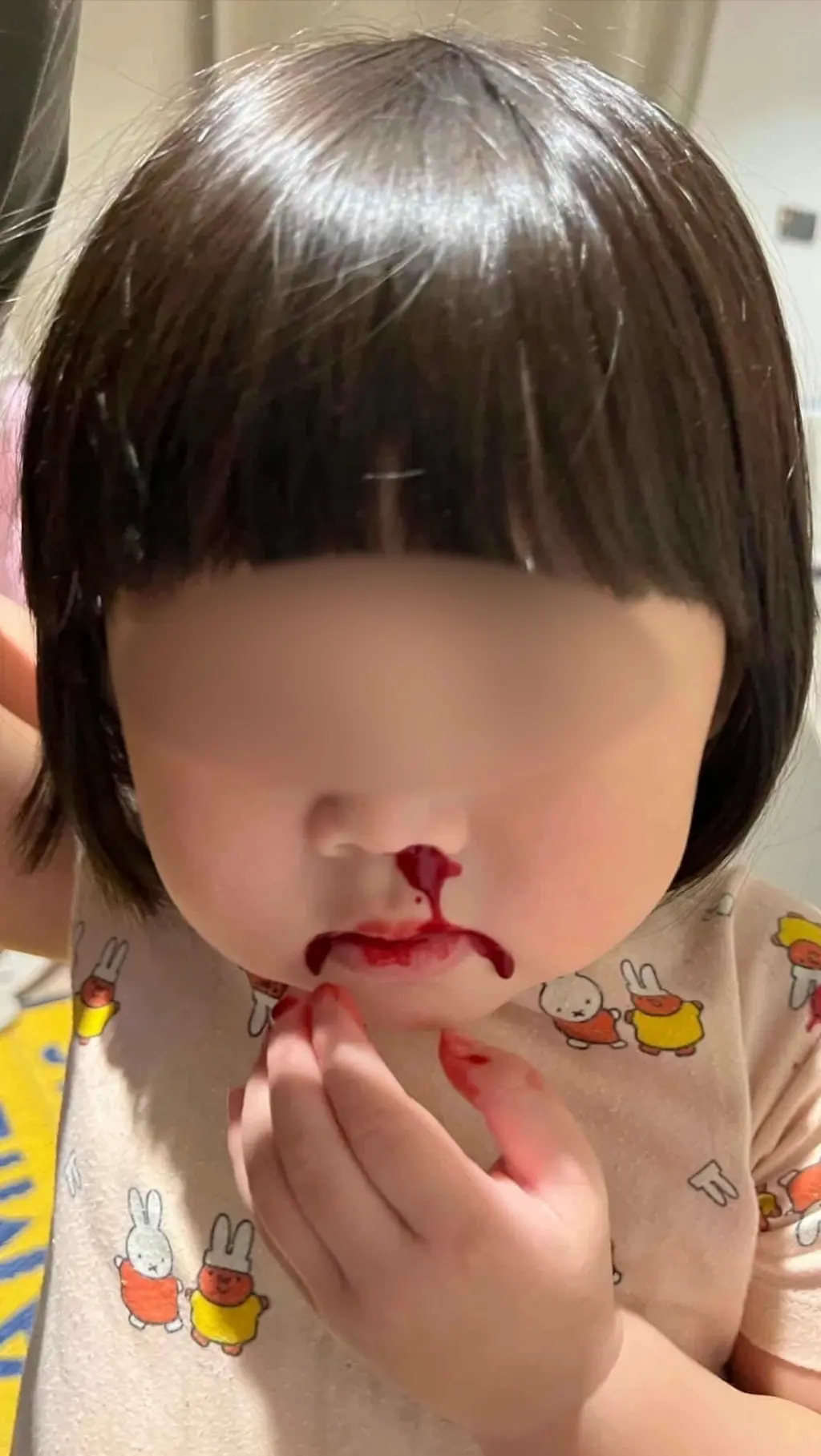 තායිලන්ත වායු  දූෂණයෙන්  දරුවන්ගේ නාසයෙන්  ලේ ගැලීම් ඉහළට