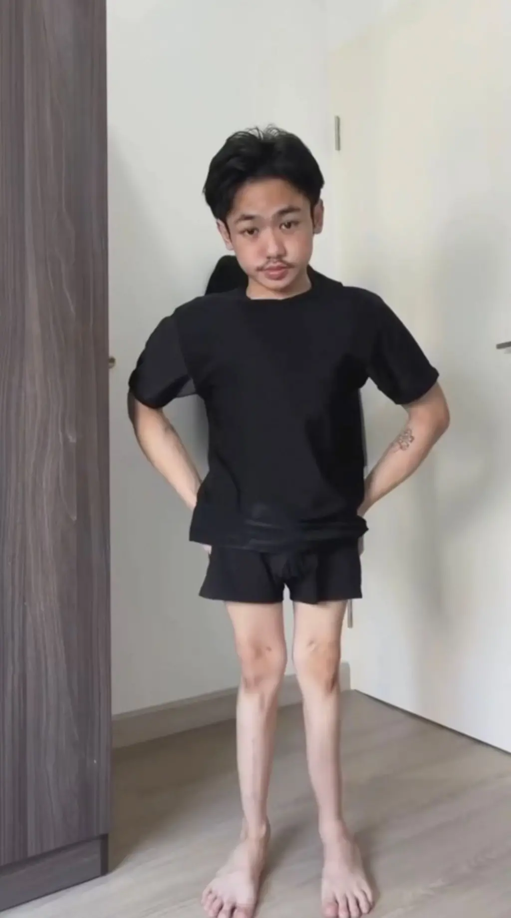"ภวินท์" ก้าวข้ามการใส่เฝือกทั้งตัว สู่แฟชันสร้างแรงใจใช้ชีวิต