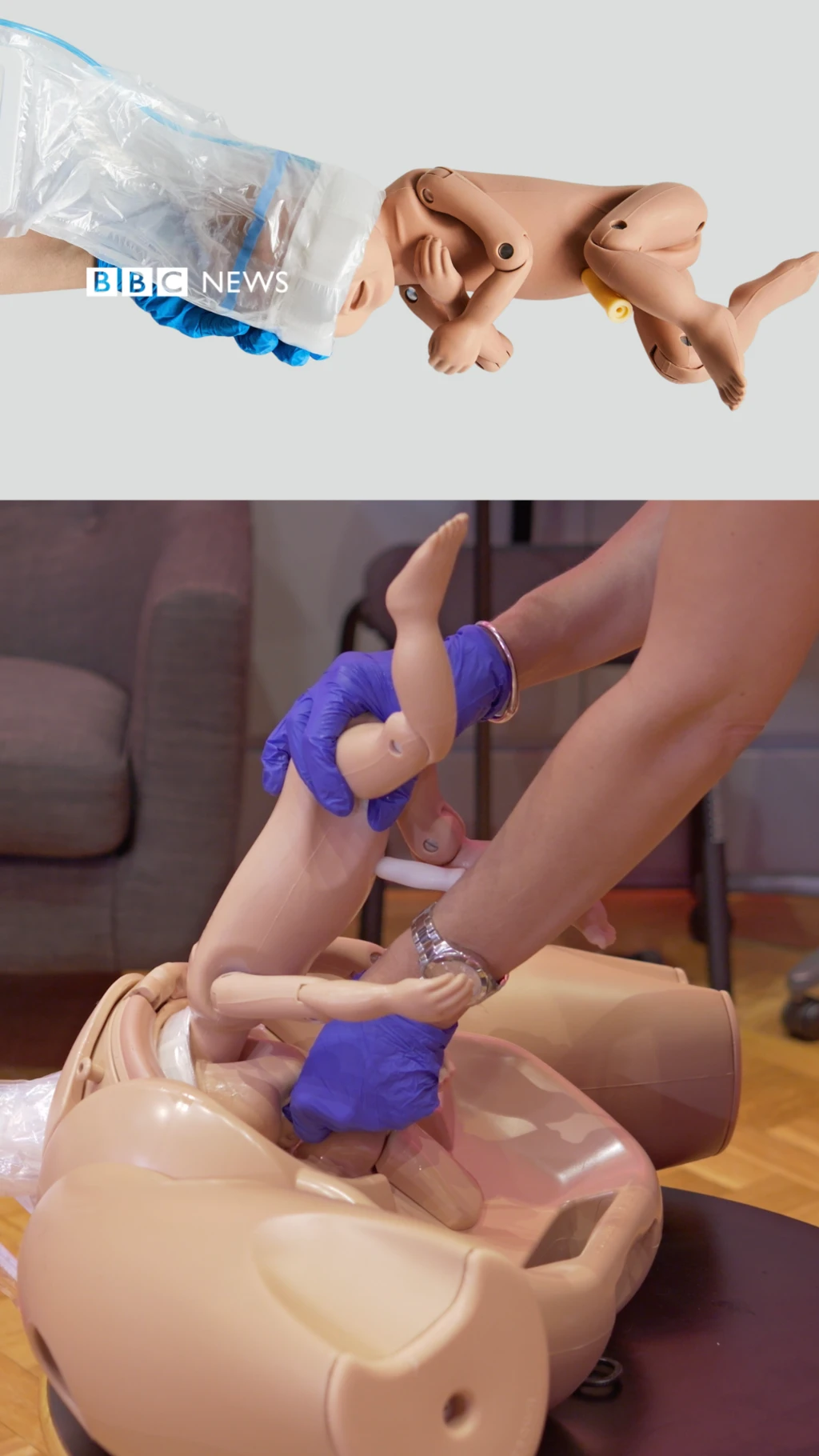 Demostración del OdonAssist